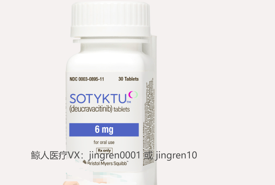 全身白癜风，还可以服用氘可来昔替尼？